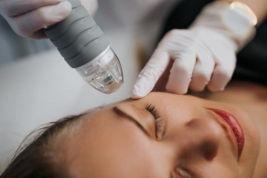 RF Microneedling Full Face